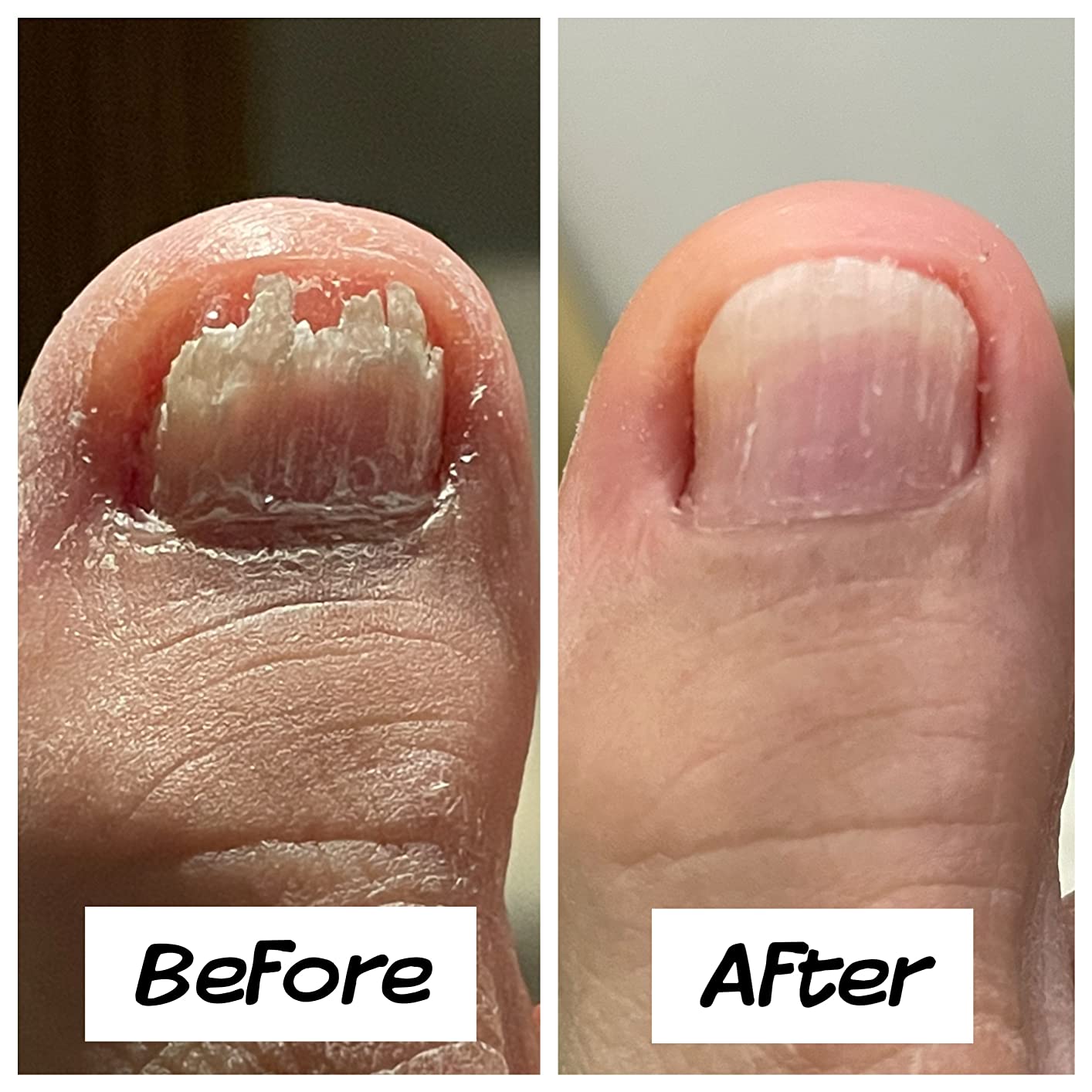 TruviRenew® Nail Aftercare Patches