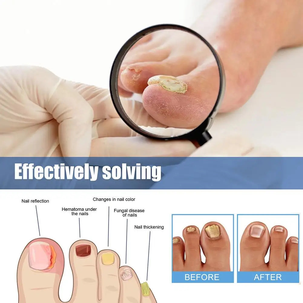 TruviRenew® Nail Aftercare Patches